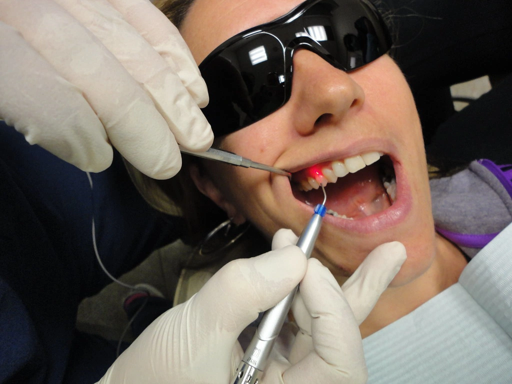 Laser Dentistry