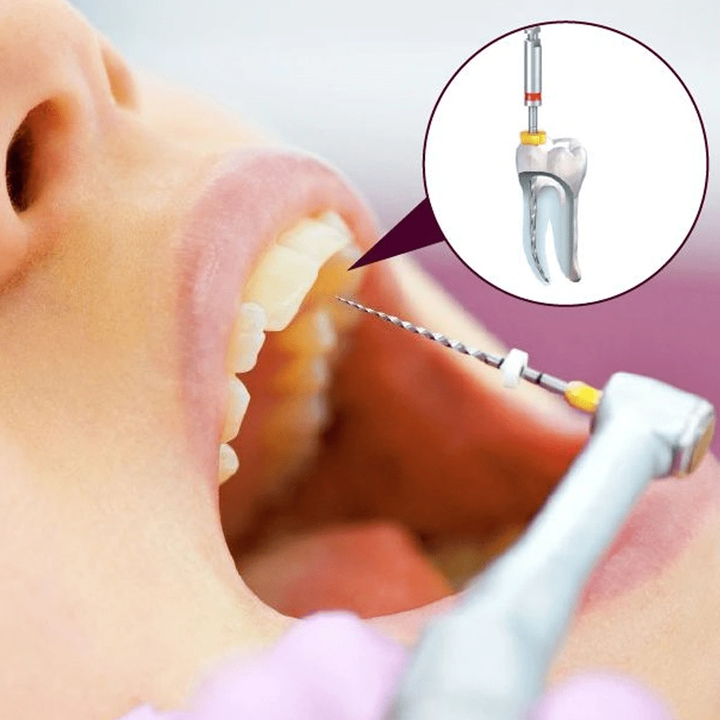 Dentist consulting a patient