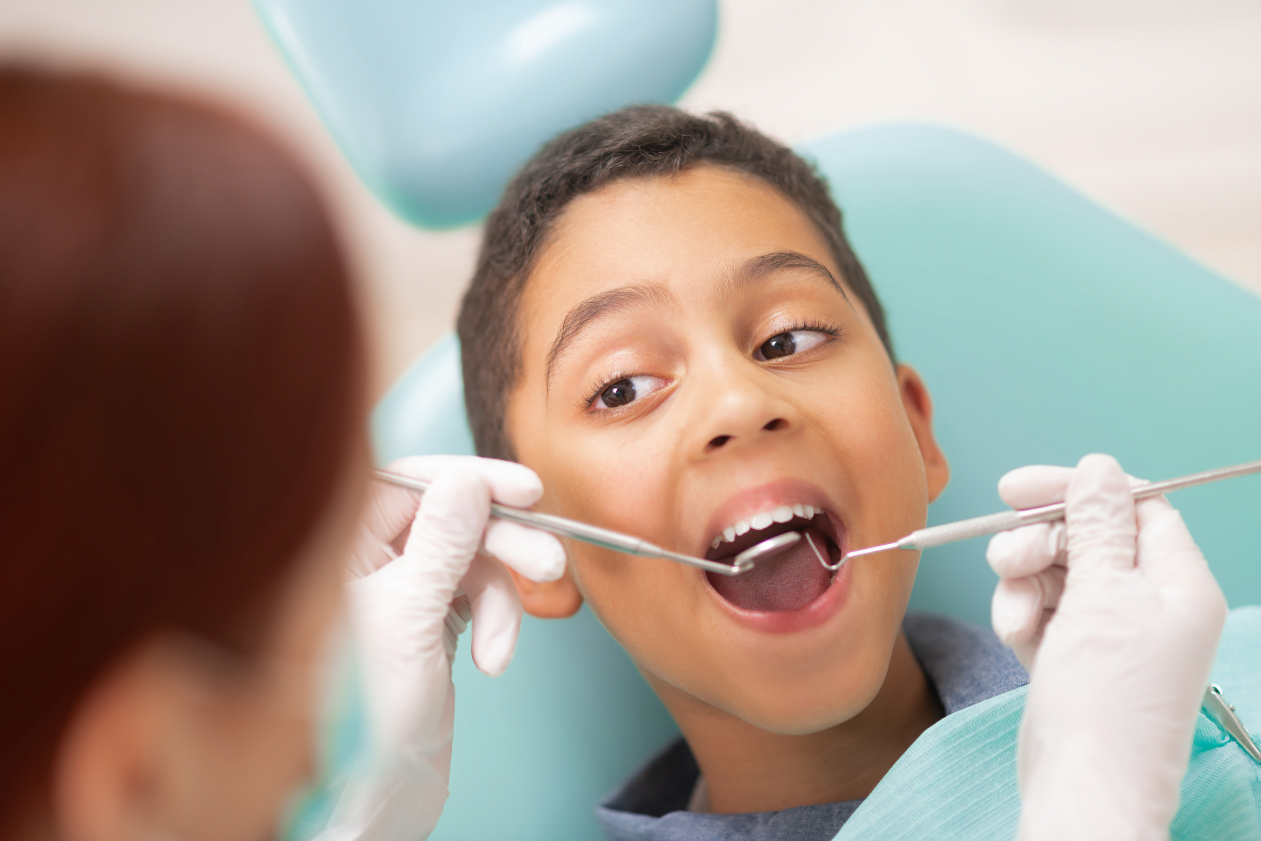 Painless Root Canal Treatment
