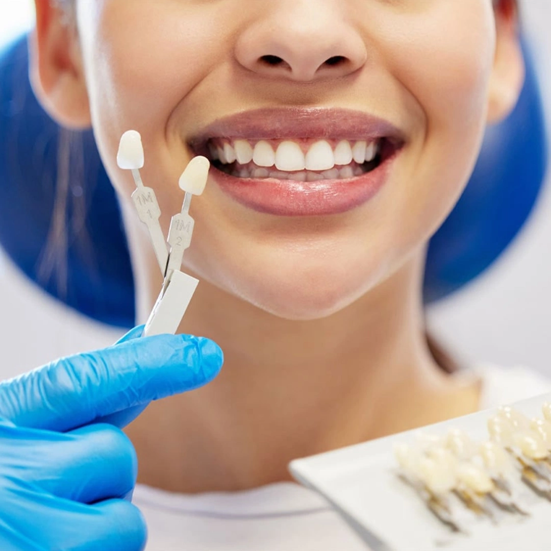 Flawless Veneer Smile