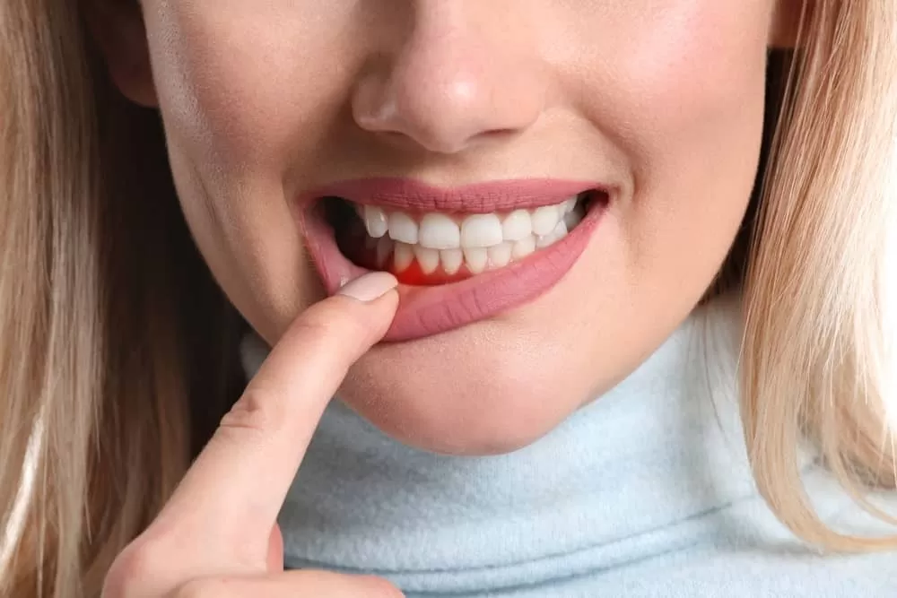Clinical Gum Assessment