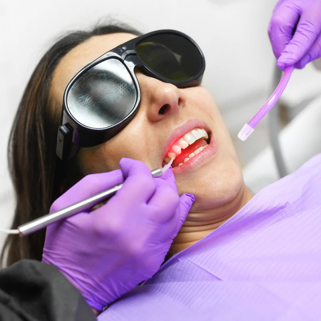Laser Dentistry Procedures