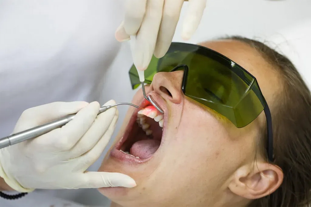 Advanced Laser Dental Care
