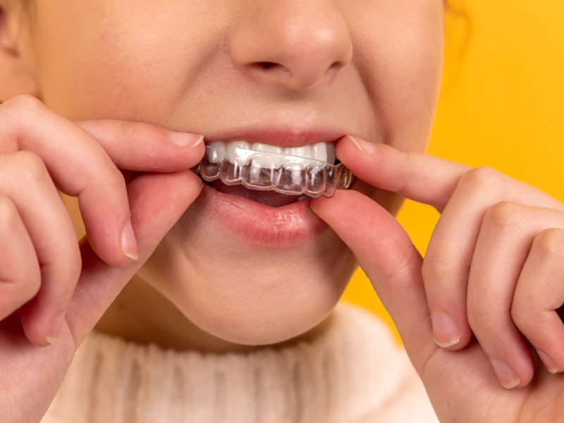 Digital Smile Design Process