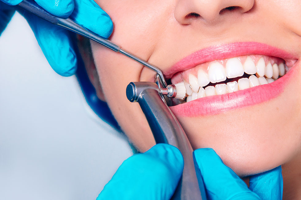 Teeth Cleaning Scaling