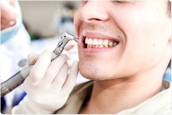 Dental Examination Process