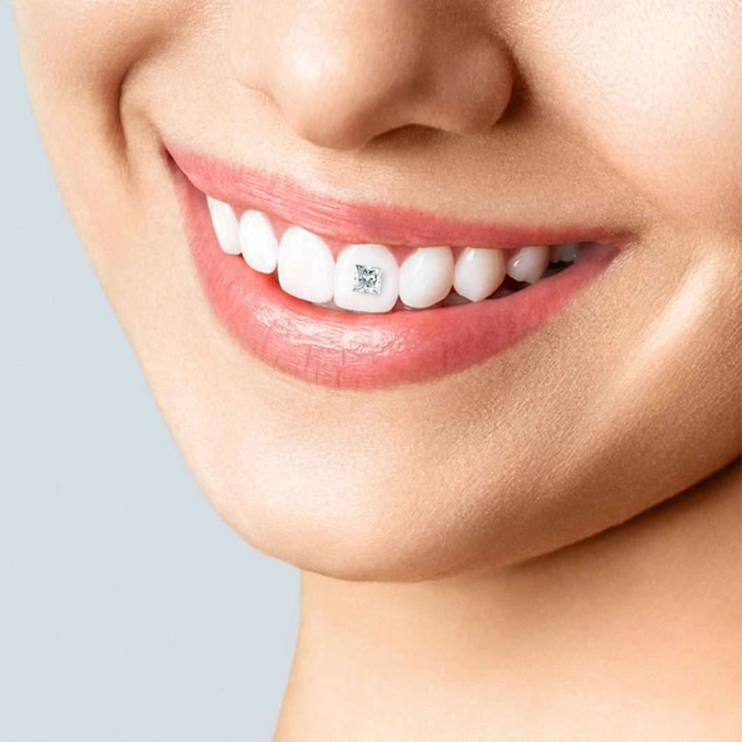 Dental consultation